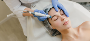 Skin Tag, Mole & Wart Removal