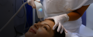 PRP + Microneedling