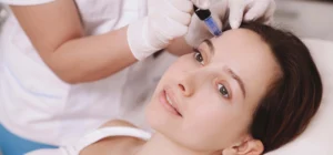 Exosome with Micro needling